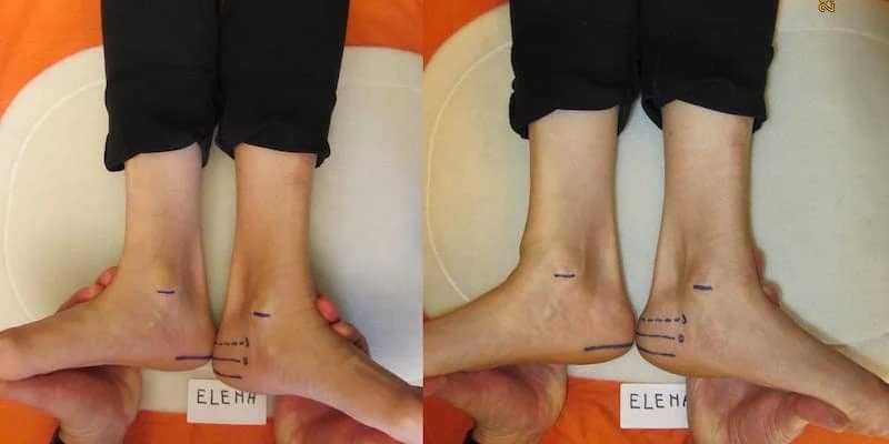 Elena-Prima-Dopo Misurazioni Prima e Dopo