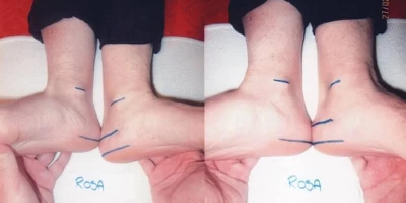 Rosy-Prima-Dopo Misurazioni Prima e Dopo