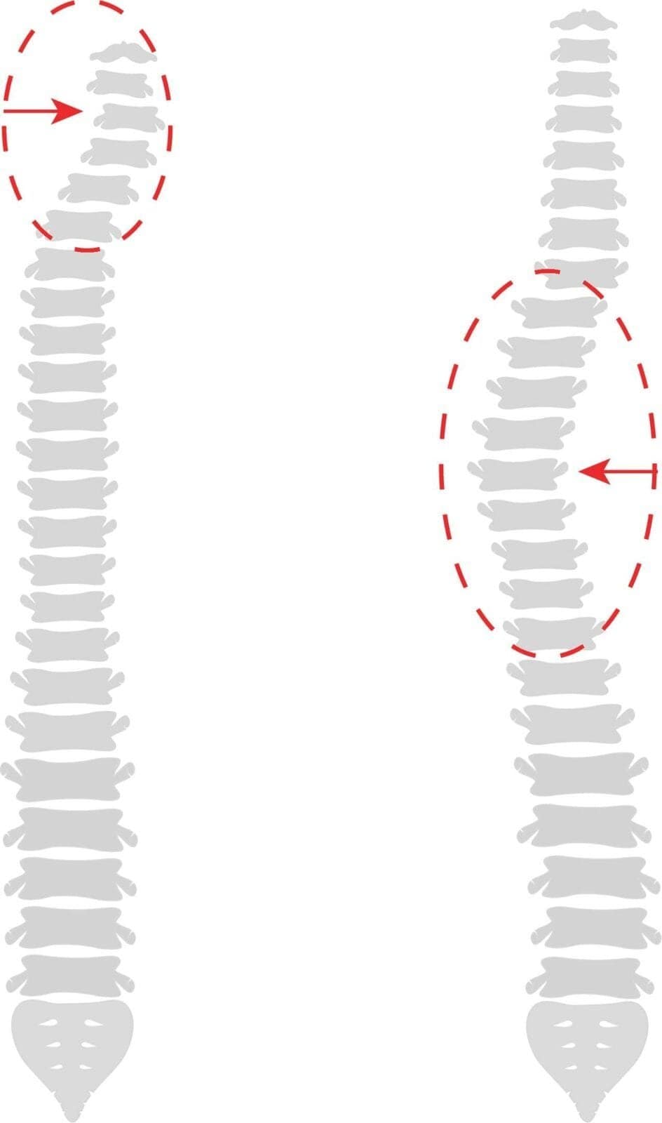 colonna Colonna Vertebrale